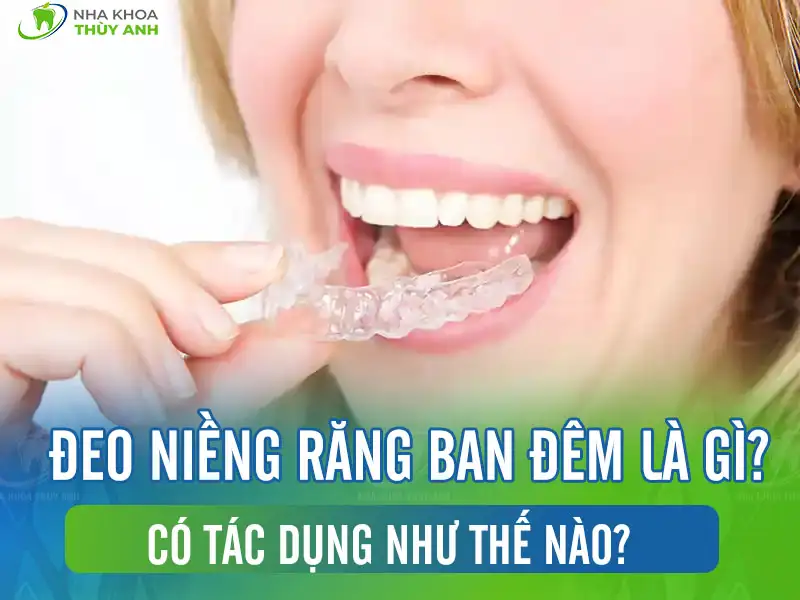 Đeo niềng răng ban đêm là gì? Có tác dụng như thế nào?