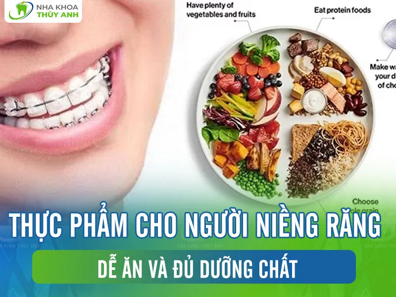 Thực phẩm cho người niềng răng dễ ăn và đủ dưỡng chất