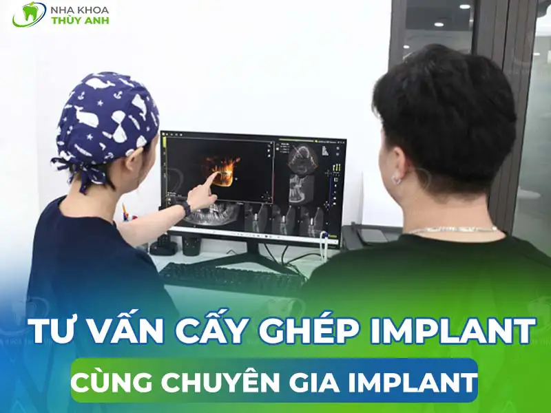 Tư vấn cấy ghép implant tại nha khoa Thùy Anh