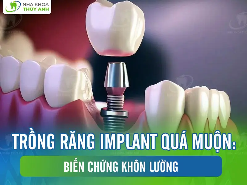 Trồng răng implant quá muộn: Biến chứng khôn lường