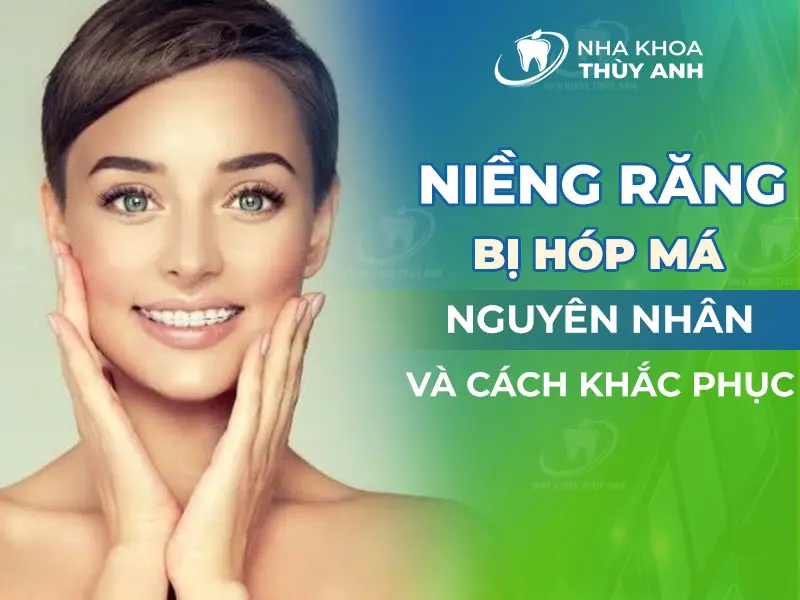 Niềng răng bị hóp má nguyên nhân và cách khắc phục