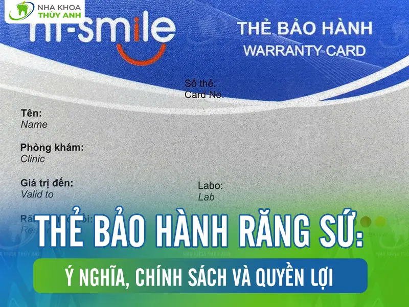 Thẻ bảo hành răng sứ: Ý nghĩa, chính sách và quyền lợi