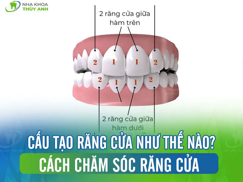 Cấu tạo răng cửa như thế nào? Cách chăm sóc răng cửa