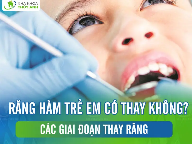 Răng hàm trẻ em có thay không? Các giai đoạn thay răng