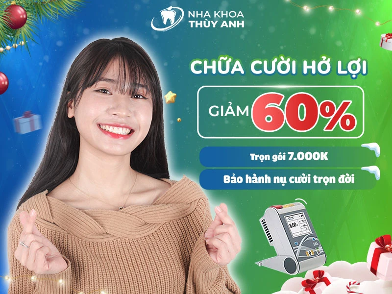 Chữa cười hở lợi giảm 60% bảo hành trọn đời