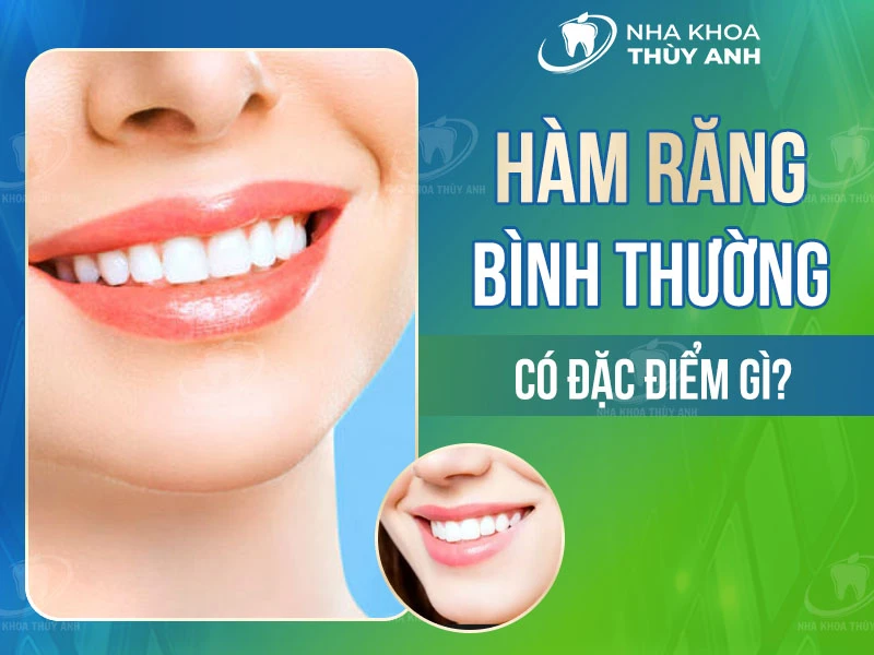 Hàm răng bình thường có đặc điểm gì?