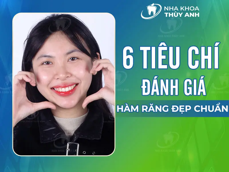 6 tiêu chí đánh giá hàm răng đẹp chuẩn