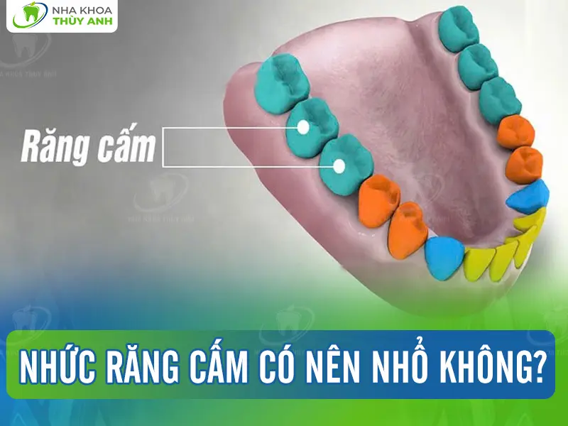 Nhức răng cấm có nên nhổ không?