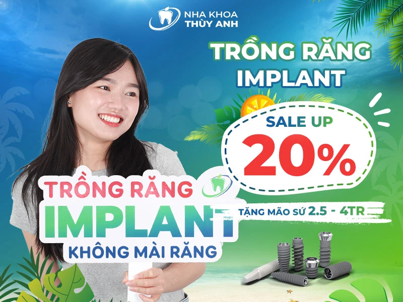 Trồng răng implant ăn ngon nhai khỏe giảm tới 20% + Giảm thêm 500k