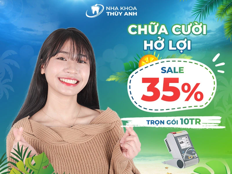 Chữa cười hở lợi giảm 35% bảo hành trọn đời