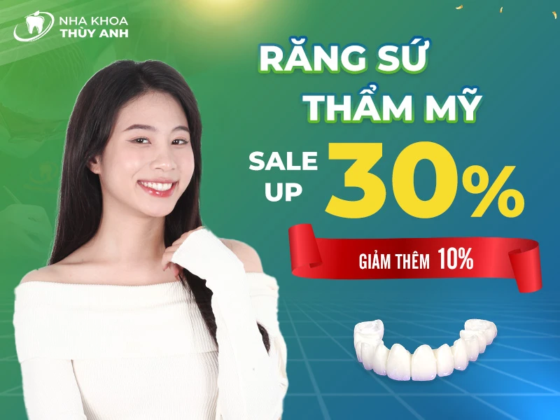 Thẩm mỹ răng sứ – Răng xinh rinh tài lộc