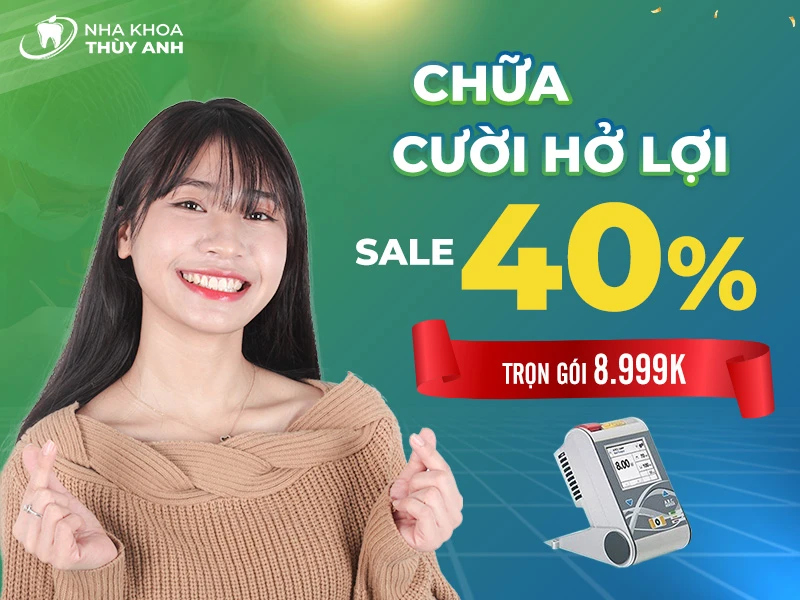 Chữa cười hở lợi giảm 50% bảo hành trọn đời