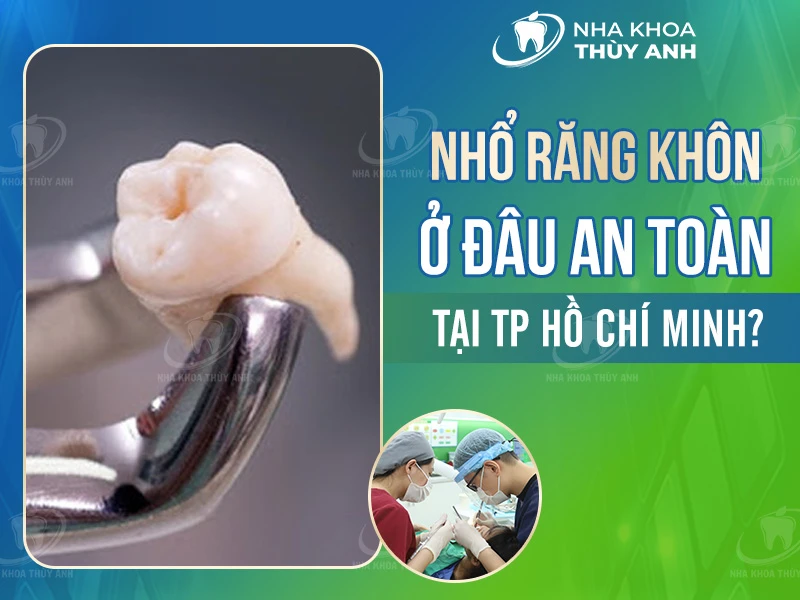Nhổ răng khôn ở đâu an toàn tại HCM