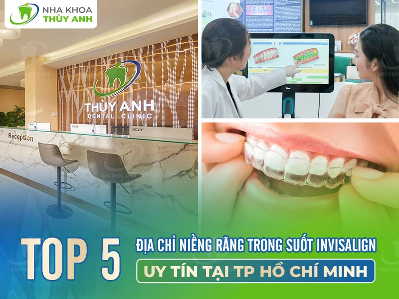 Top 5 địa chỉ niềng răng trong suốt invisalign HCM uy tín
