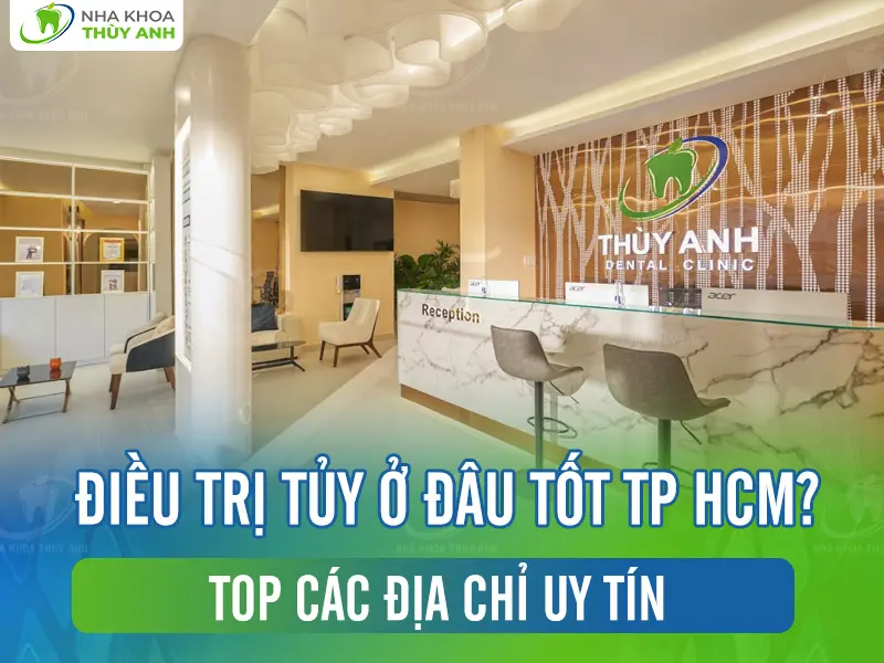 Điều trị tủy ở đâu tốt TP HCM? Top các địa chỉ uy tín