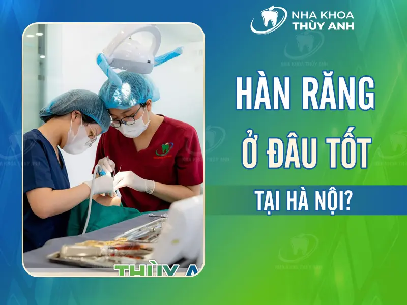 Hàn răng ở đâu tốt Hà Nội? Gợi ý 4 địa chỉ uy tín