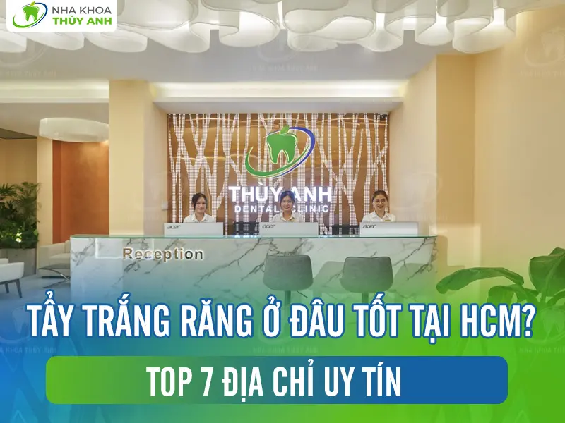 Tẩy trắng răng ở đâu tốt tại HCM? Top 7 địa chỉ uy tín