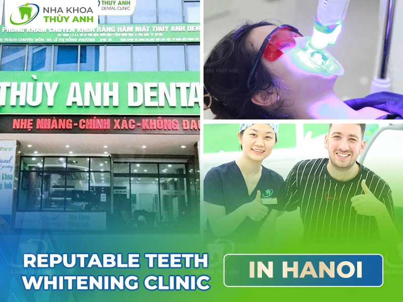 Reputable Teeth Whitening Clinic in Hanoi