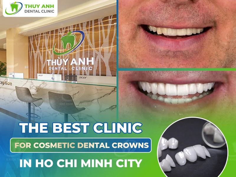 The Best Clinic for Cosmetic Dental Crowns in Ho Chi Minh City
