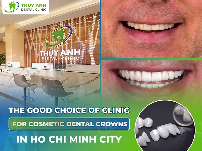Good choice Clinic for Cosmetic Dental Crowns in Ho Chi Minh City