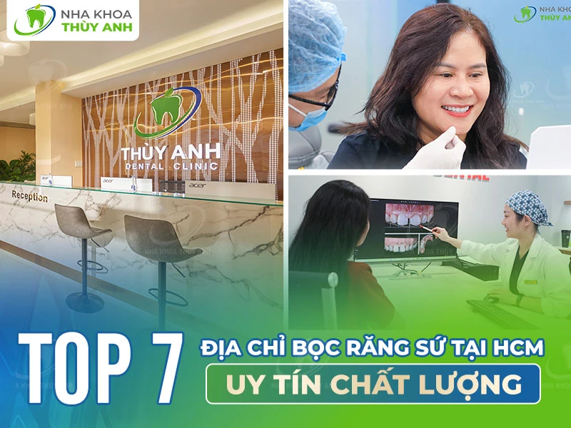 Top 7 địa chỉ bọc răng sứ tại HCM uy tín chất lượng