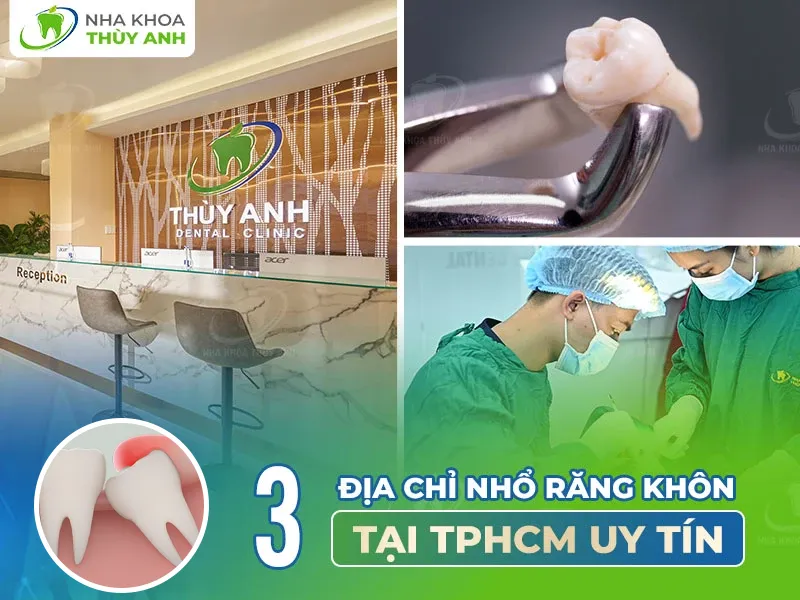 3 địa chỉ nhổ răng khôn tại TPHCM uy tín