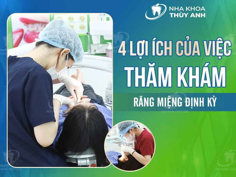 4 lợi ích của việc thăm khám răng miệng định kỳ