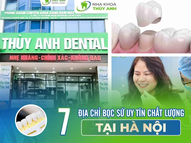7 địa chỉ bọc sứ uy tín chất lượng tại Hà Nội