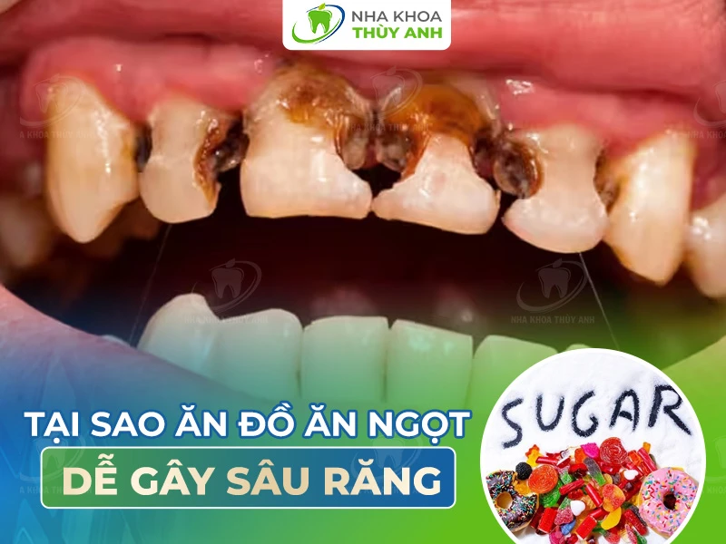 Tại sao ăn đồ ngọt dễ gây sâu răng?
