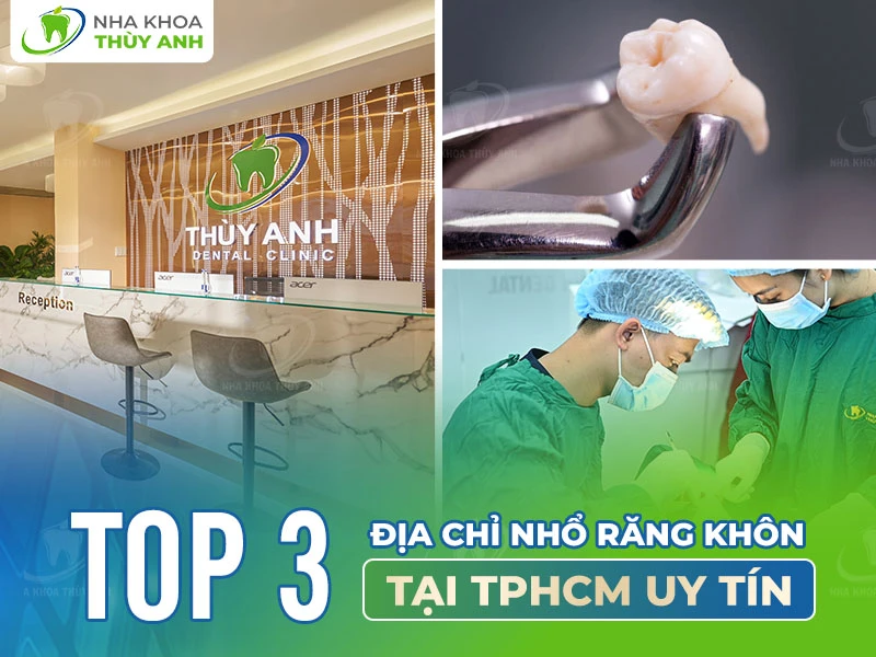 Top 3 địa chỉ nhổ răng khôn tại TPHCM uy tín