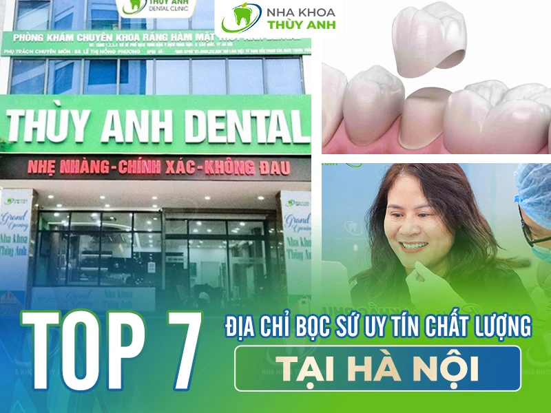 Top 7 địa chỉ bọc sứ uy tín chất lượng tại Hà Nội