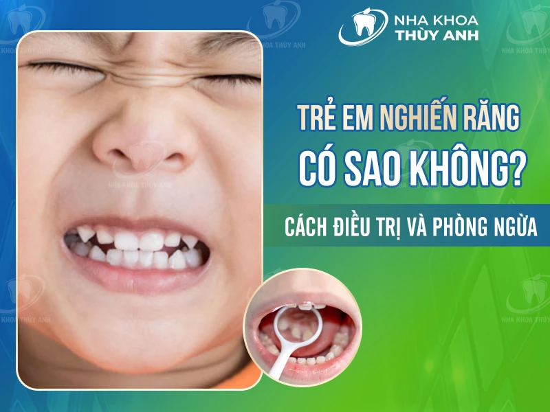 Trẻ em nghiến răng có sao không? Cách điều trị và phòng ngừa