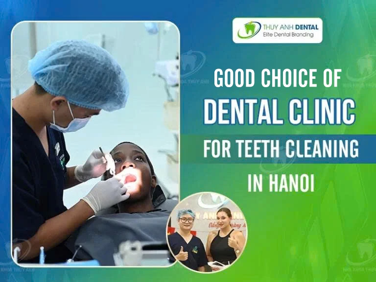 Good choice dental clinic for teeth cleaning in Hanoi
