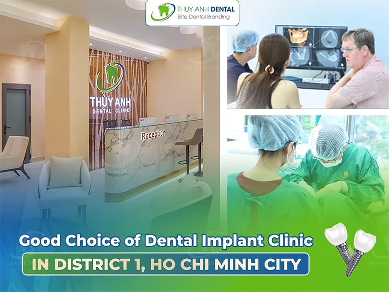 Good Choice Dental Implant Clinic in District 1