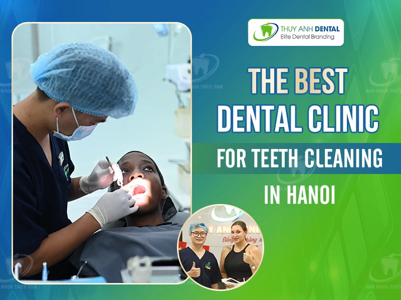 The best dental clinic for teeth cleaning in Hanoi