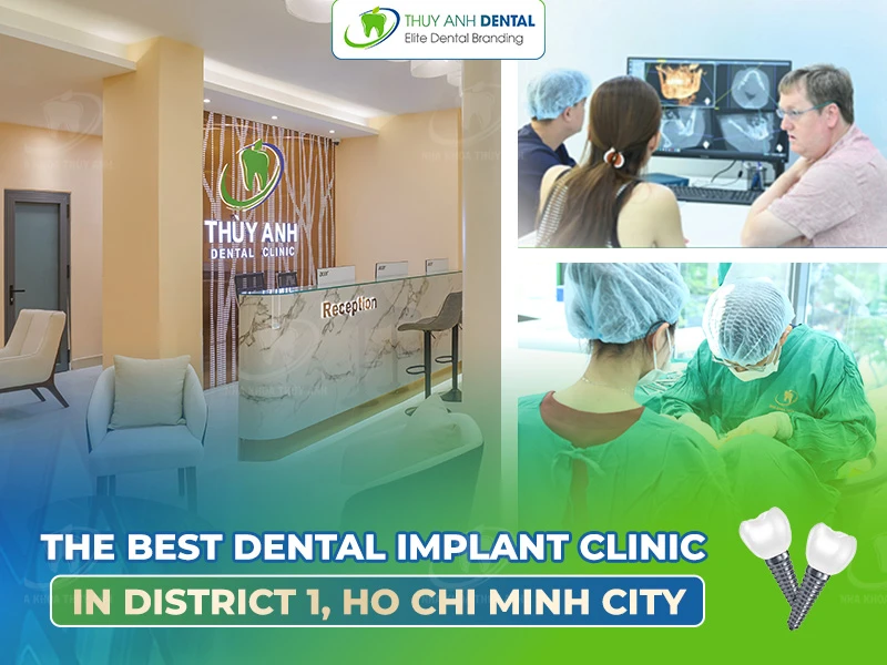 The Best Dental Implant Clinic in District 1