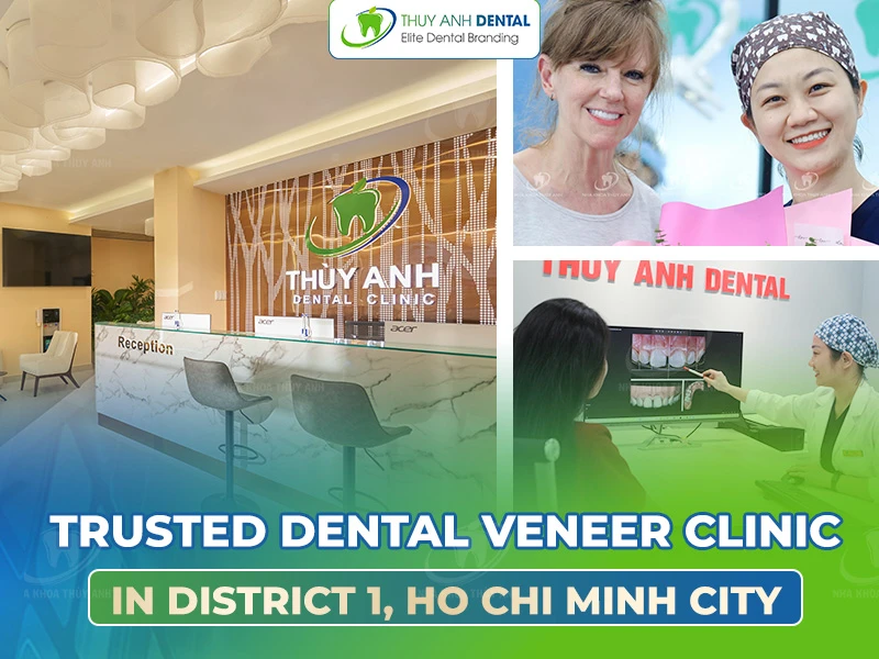 Trusted Dental Veneer Clinic with International Standards in Ho Chi Minh City