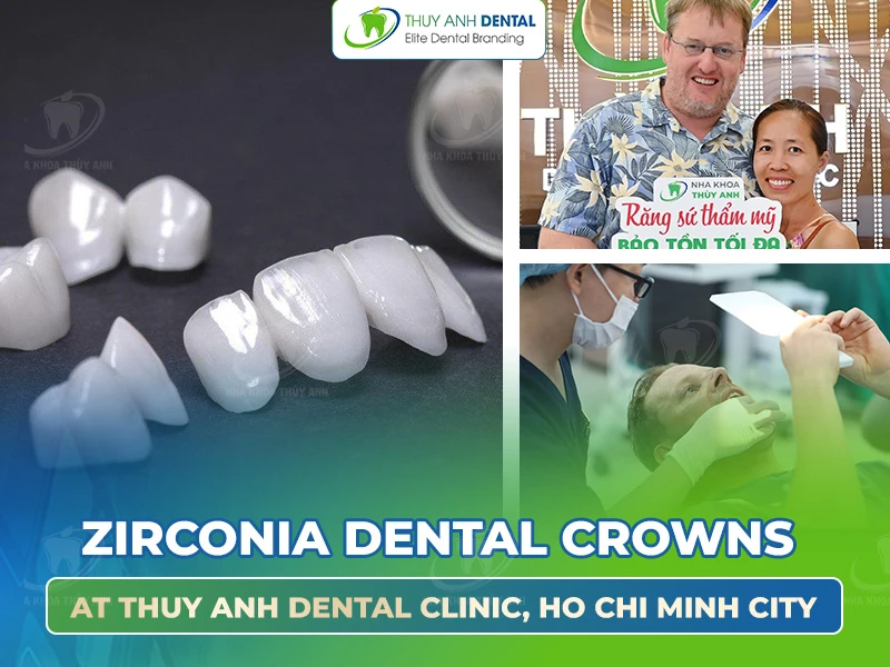 Zirconia Dental Crowns at Thuy Anh Dental Clinic, Ho Chi Minh City