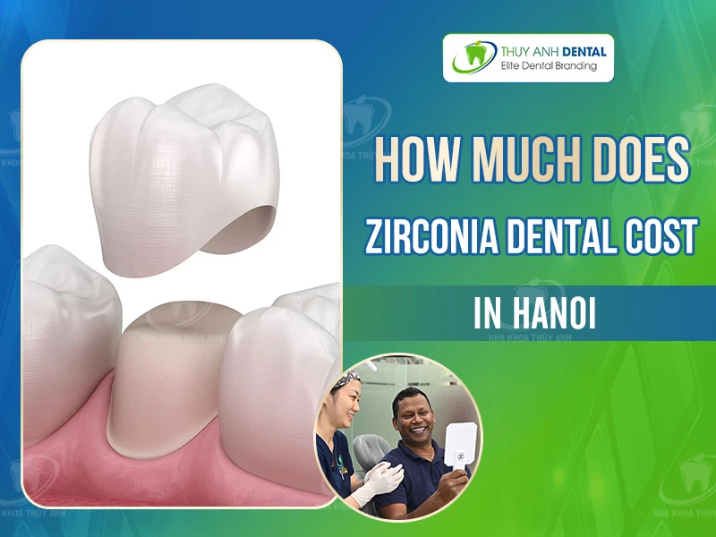 How Much Does Zirconia Dental Crown Cost in Hanoi?