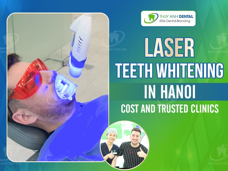 Laser Teeth Whitening in Hanoi: Cost and Trusted Clinics