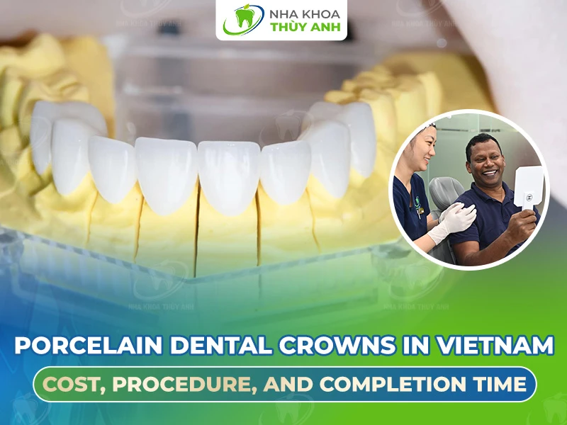 Porcelain Dental Crowns in Vietnam: Cost, Procedure, and Completion Time