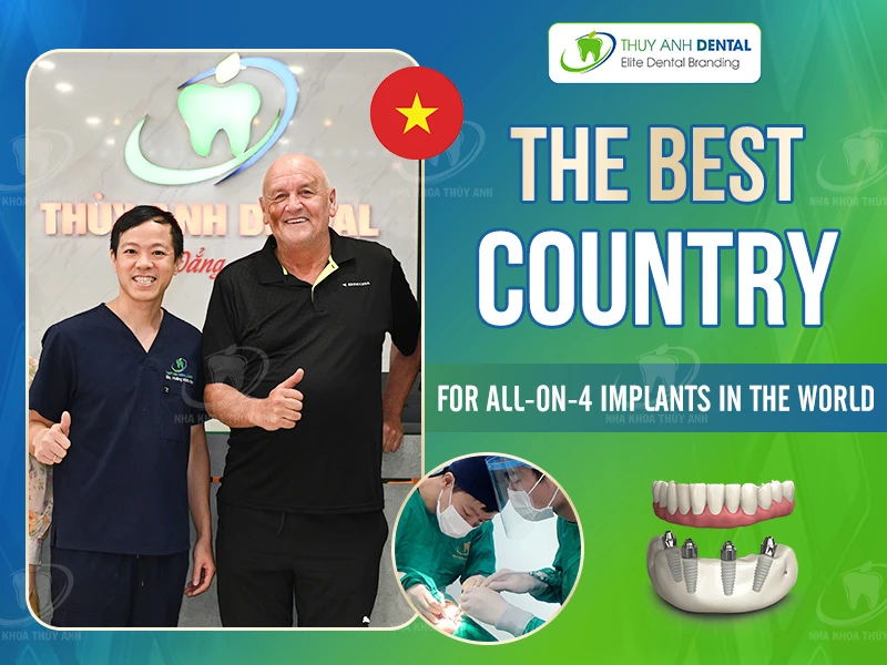The Best Country for All-on-4 Implants in the World