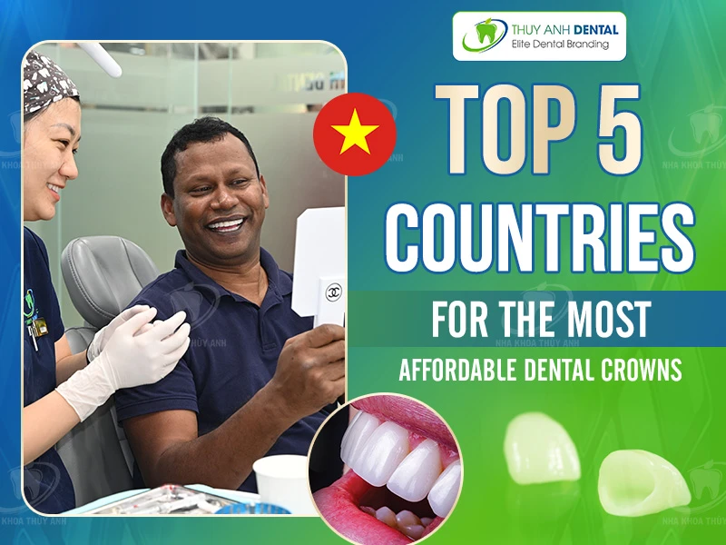 Top 5 Countries for the Most Affordable Dental Crowns