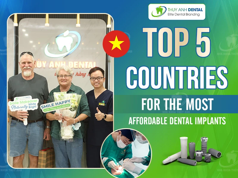 Top 5 Countries for the Most Affordable Dental Implants
