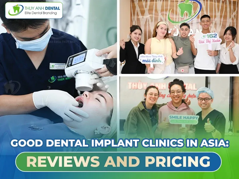 Good Dental Implant Clinics in Asia: Reviews and Pricing