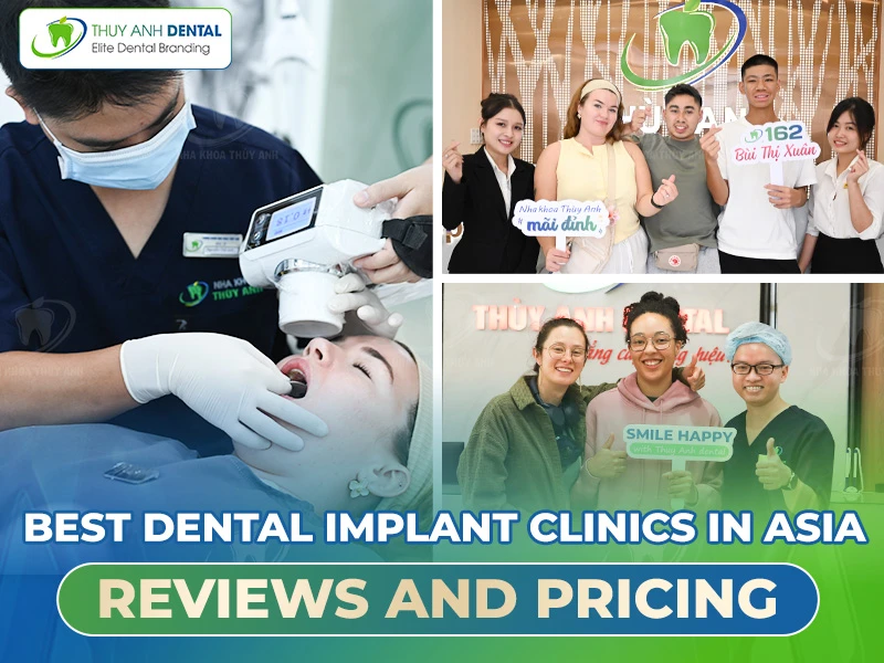 Best Dental Implant Clinics in Asia: Reviews and Pricing