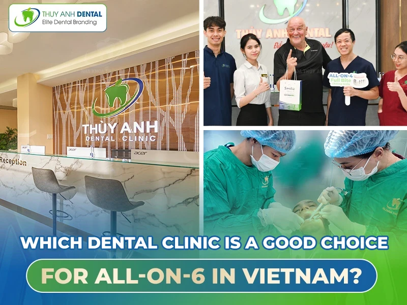 Which dental clinic is a good choice for All-on-6 in Vietnam?