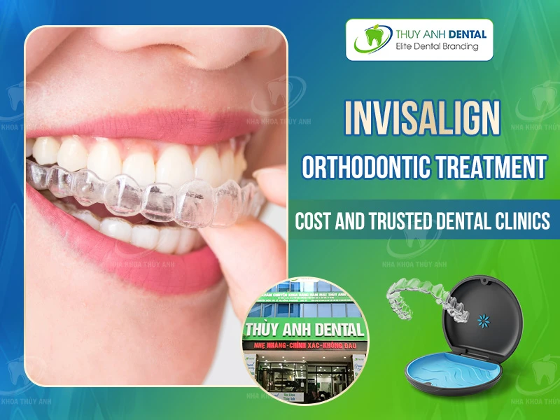 Invisalign Orthodontic Treatment in Hanoi: Cost and Trusted Dental Clinics