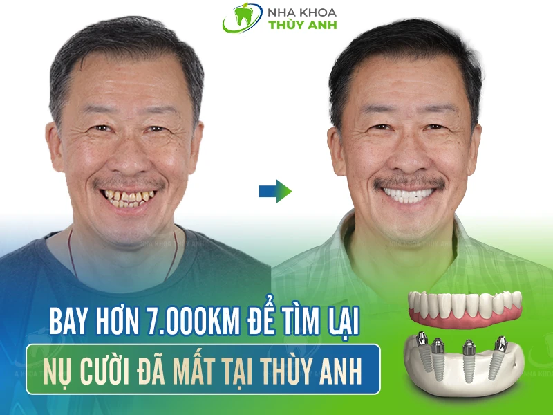 Warren Lee – 67 tuổi