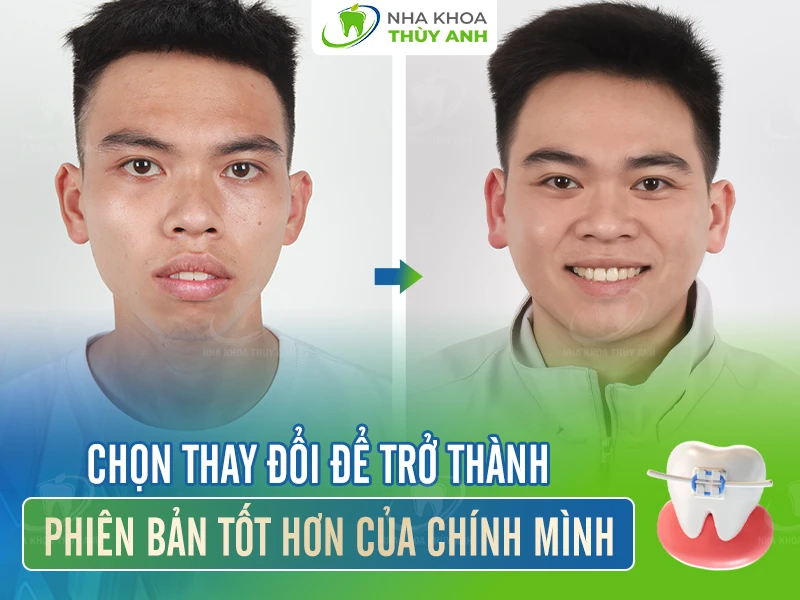 Quang Trường – 30 tuổi